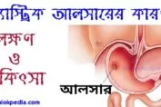 আলসার, গ্যাস্ট্রিক আলসারের কারণ, লক্ষণ ও চিকিৎসা